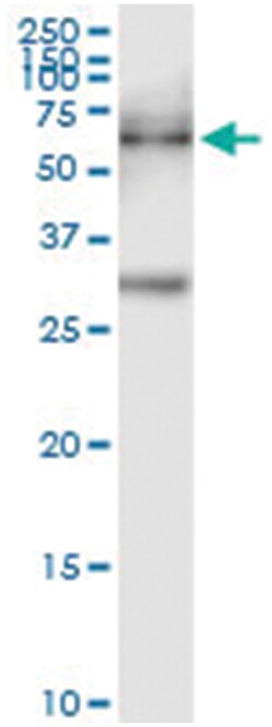 anti-PKMYT1, Human, IP-WB Antibody Pair, Abnova&trade;