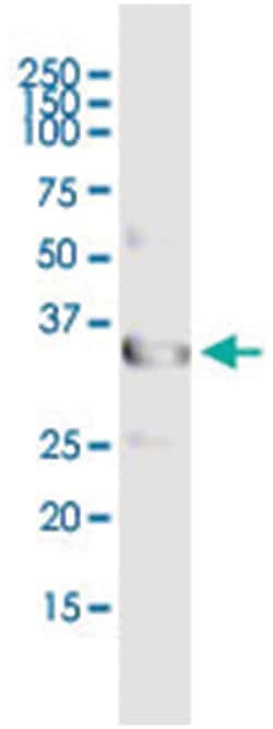 UNC119, Human, IP-WB Antibody Pair (PW3), Abnova 1 Set:Antibodies, Monoclonal/Polyclonal