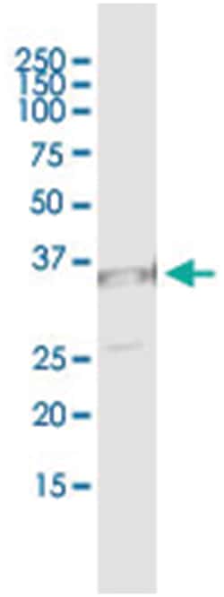 UNC119, Human, IP-WB Antibody Pair (PW4), Abnova™