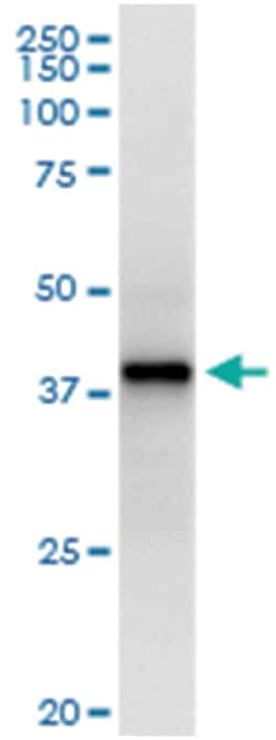 anti-NMI, Human, IP-WB Antibody Pair, Abnova&trade;