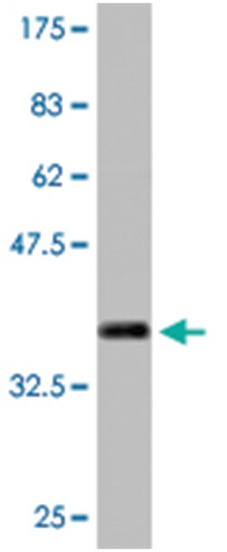 MTA1, Mouse, Clone: 3A3, Abnova 200&mu;L; Unlabeled:Antibodies, Monoclonal