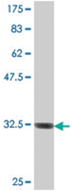 SEC22L3, Mouse, Polyclonal Antibody, Abnova 50 &mu;L | Buy Online | Abnova | Fisher Scientific