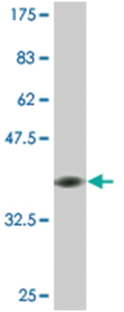 keratin 75, Mouse, Clone: 2E3, Abnova 200&mu;L; Unlabeled:Antibodies, Monoclonal