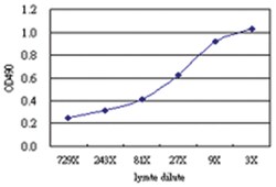 anti-PDLIM1 Matched Antibody Pair, Abnova™