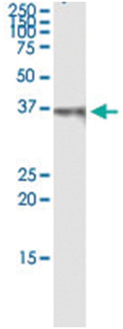 anti-PDLIM1, Human, IP-WB Antibody Pair, Abnova&trade;