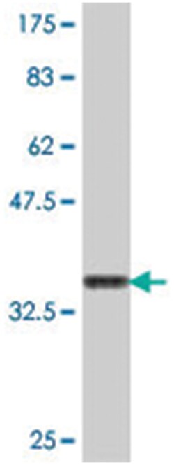 AP4M1, Mouse, Polyclonal Antibody, Abnova 50&mu;L; Unlabeled:Antibodies,