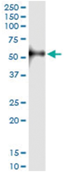anti-OSMR, Human, IP-WB Antibody Pair, Abnova™