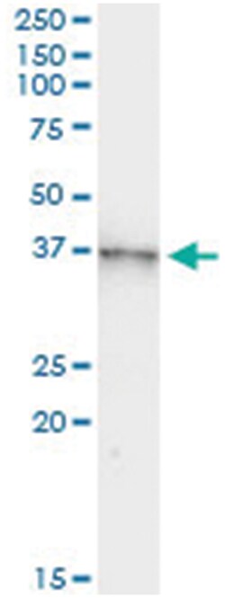 anti-AURKB, Human, IP-WB Antibody Pair, Abnova&trade;