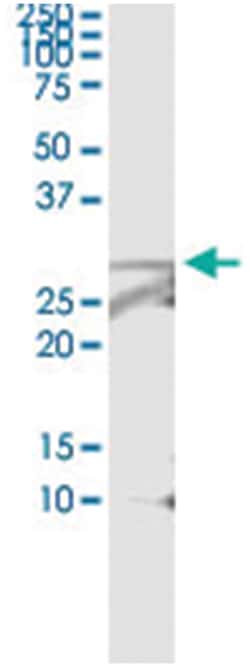 anti-VAPB, Human, IP-WB Antibody Pair, Abnova&trade;