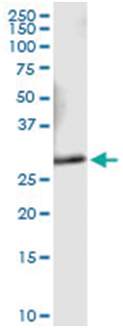 anti-VAPA, Human, IP-WB Antibody Pair, Abnova 1 Set:Antibodies, Monoclonal/Polyclonal