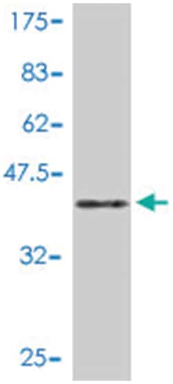 PTTG1, Mouse, Polyclonal Antibody, Abnova 50 &mu;L | Buy Online | Abnova Corporation | Fisher Scientific