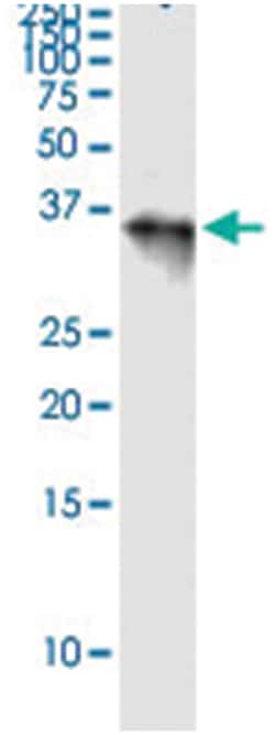 anti-PNMA1, Human, IP-WB Antibody Pair, Abnova 1 Set:Antibodies, Monoclonal/Polyclonal