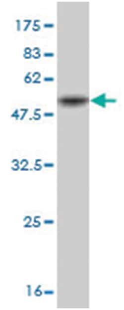 NOG, Mouse, Clone: 2E10, Abnova&trade;