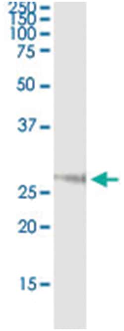 anti-NOG, Human, IP-WB Antibody Pair, Abnova&trade;