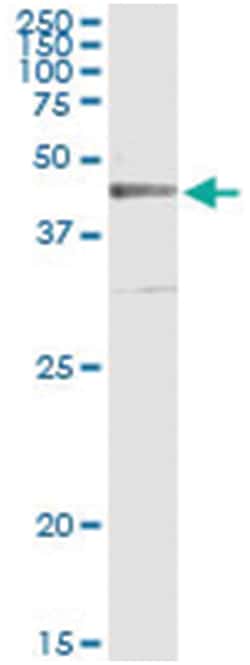 anti-CRLF1, Human, IP-WB Antibody Pair, Abnova 1 Set:Antibodies, Monoclonal/Polyclonal