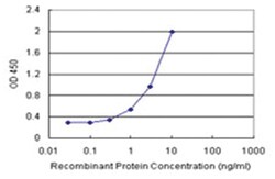 anti-UBE2L6 Matched Antibody Pair, Abnova