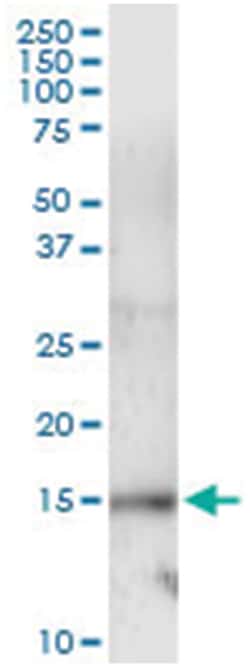 anti-UBE2L6, Human, IP-WB Antibody Pair, Abnova&trade;