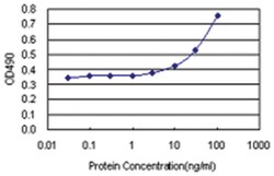 anti-RPS6KA5 Matched Antibody Pair, Abnova&trade; 1 set, Unlabeled 