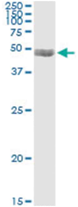 PDLIM7, Human, IP-WB Antibody Pair (PW2), Abnova&trade;