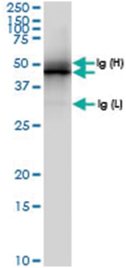 MAPKAPK2, Human, IP-WB Antibody Pair (PW1), Abnova&trade;