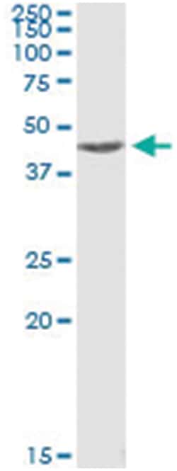 MAPKAPK2, Human, IP-WB Antibody Pair (PW3), Abnova&trade;