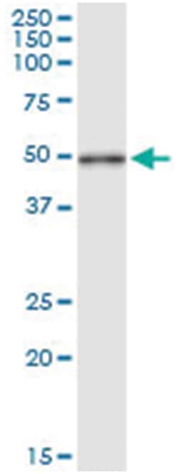 anti-CYTH2, Human, IP-WB Antibody Pair, Abnova 1 Set:Antibodies, Monoclonal/Polyclonal