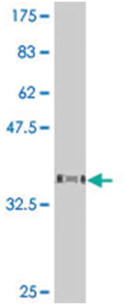 NPIP, Mouse, Polyclonal Antibody, Abnova 50&mu;L; Unlabeled:Antibodies