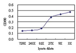 anti-SOCS6 Matched Antibody Pair, Abnova™
