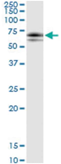 anti-SOCS6, Human, IP-WB Antibody Pair, Abnova™