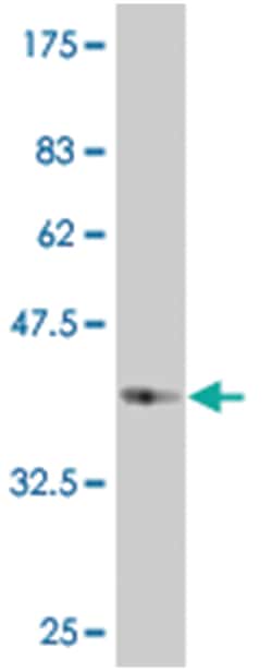 B4GALT5, Mouse, Clone: 7E6, Abnova 200&mu;L; Unlabeled:Antibodies, Monoclonal