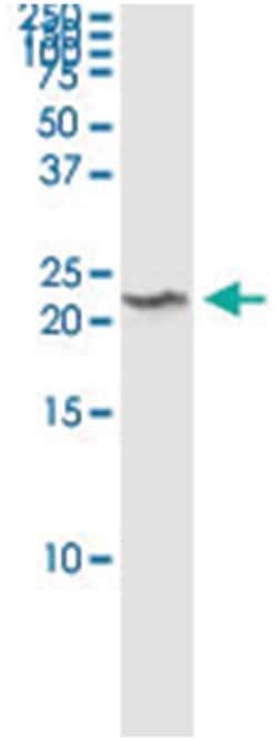TCEAL1, Human, IP-WB Antibody Pair (PW3), Abnova&trade;