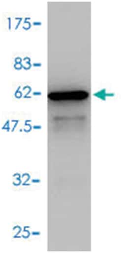 SNAP29, Mouse, Polyclonal Antibody, Abnova 50&mu;L; Unlabeled:Antibodies,