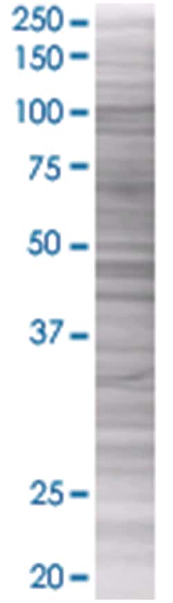 CER1 293T Cell Overexpression Lysate (Denatured), Abnova 100 &mu;L | Buy Online | Abnova | Fisher Scientific