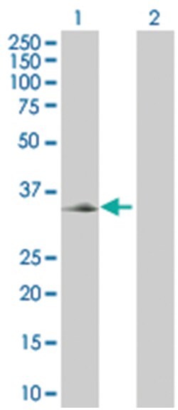 CER1 293T Cell Overexpression Lysate (Denatured), Abnova 100 &mu;L | Buy Online | Abnova | Fisher Scientific