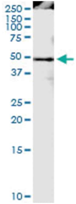 anti-PPIG, Human, IP-WB Antibody Pair, Abnova 1 Set:Antibodies, Monoclonal/Polyclonal