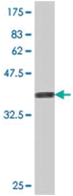 PLAA, Mouse, Polyclonal Antibody, Abnova 50&mu;L; Unlabeled:Antibodies,