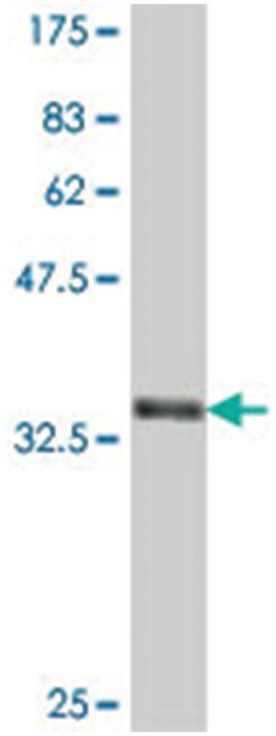 PPT2, Mouse, Polyclonal Antibody, Abnova 50 &mu;L | Buy Online | Abnova | Fisher Scientific