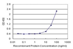 anti-GRHPR Matched Antibody Pair, Abnova