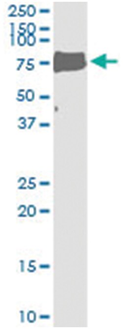 anti-LIPG, Human, IP-WB Antibody Pair, Abnova 1 Set:Antibodies, Monoclonal/Polyclonal
