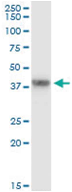 GRAP2, Human, IP-WB Antibody Pair (PW3), Abnova&trade;