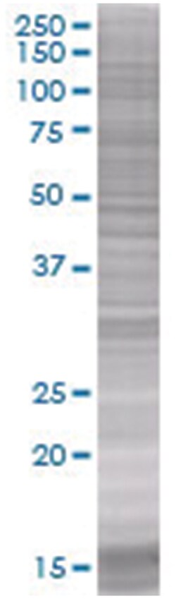 GRAP2 293T Cell Overexpression Lysate 1 (Denatured), Abnova 100 &mu;L | Buy Online | Abnova | Fisher Scientific