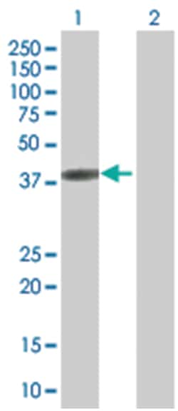 GRAP2 293T Cell Overexpression Lysate 1 (Denatured), Abnova 100 &mu;L | Buy Online | Abnova | Fisher Scientific