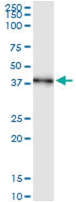 anti-AIM2, Human, IP-WB Antibody Pair, Abnova&trade;