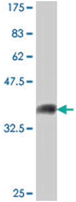 MAP4K4, Mouse, Polyclonal Antibody, Abnova 50&mu;L; Unlabeled:Antibodies,