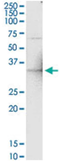 anti-GGPS1, Human, IP-WB Antibody Pair, Abnova&trade;
