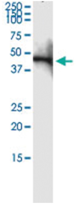 anti-HOMER1, Human, IP-WB Antibody Pair, Abnova 1 Set:Antibodies, Monoclonal/Polyclonal