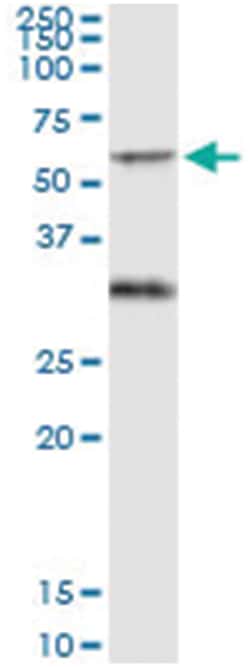 anti-PICK1, Human, IP-WB Antibody Pair, Abnova&trade;