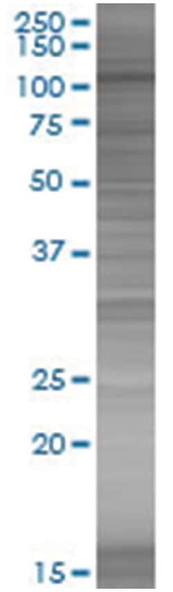 KIF23 293T Cell Overexpression Lysate (Denatured), Abnova 100 &mu;L | Buy Online | Abnova | Fisher Scientific
