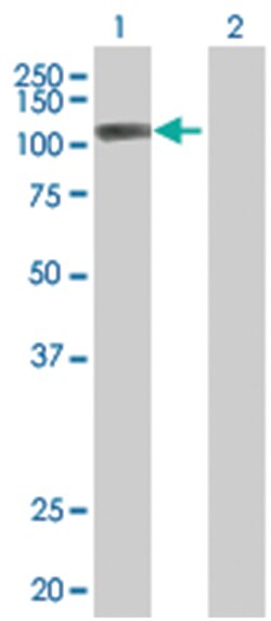 KIF23 293T Cell Overexpression Lysate (Denatured), Abnova 100 &mu;L | Buy Online | Abnova | Fisher Scientific