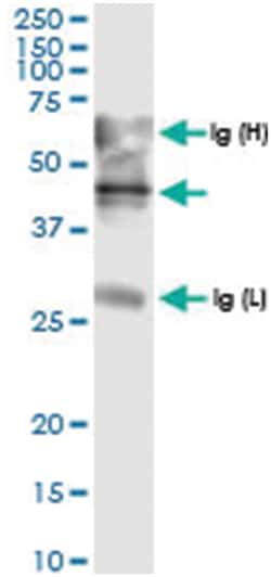 ADAMTS4, Human, IP-WB Antibody Pair (PW1), Abnova&trade;